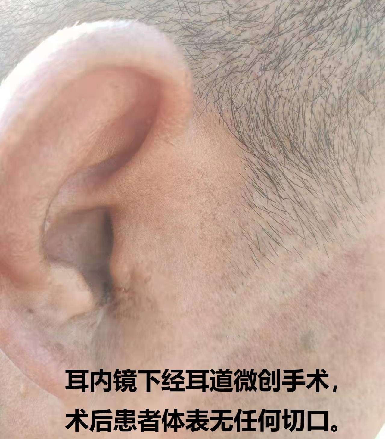 202201050834032910.png