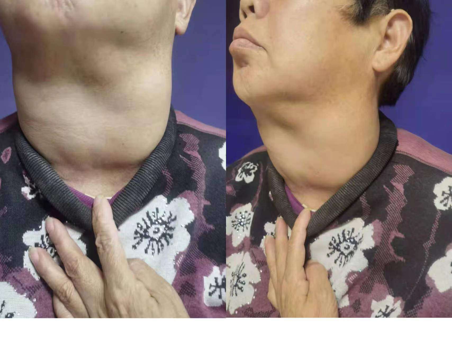 202201241715270735.png
